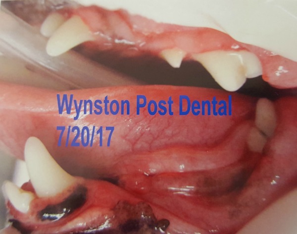 Wynston's dental surgery recap